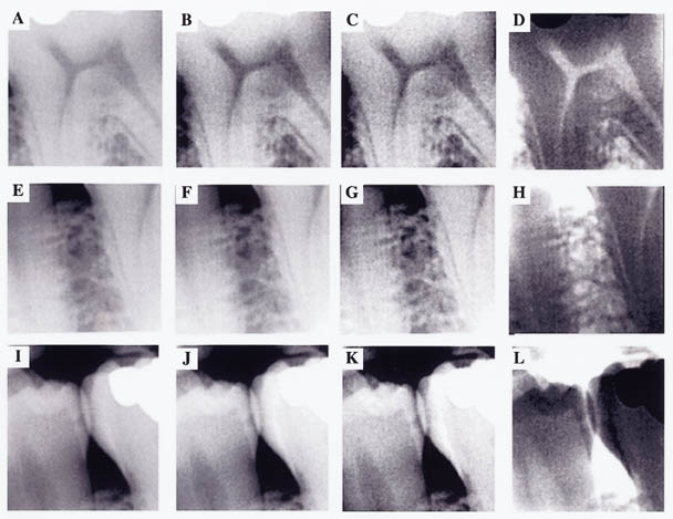 x-ray collection