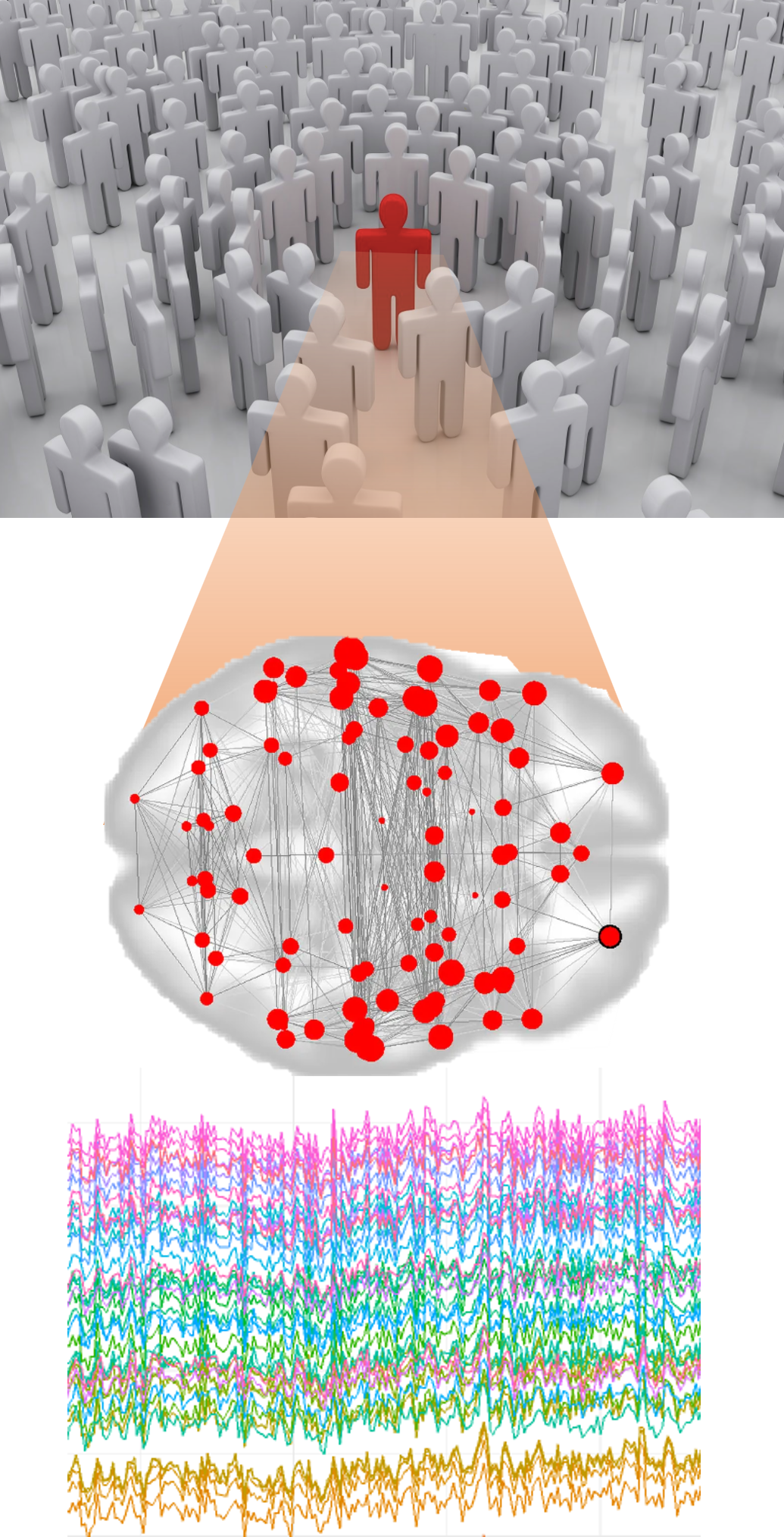 Brain network reconstruction figure